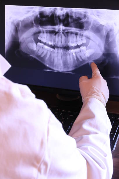 Best Emergency Wisdom Tooth Extraction in Country Walk, FL