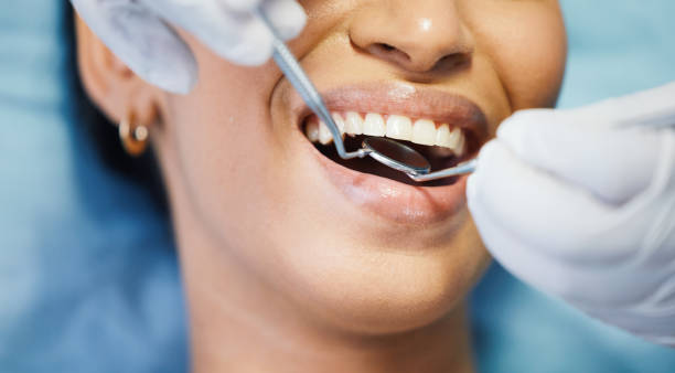 Best Emergency Denture Repair in Country Walk, FL